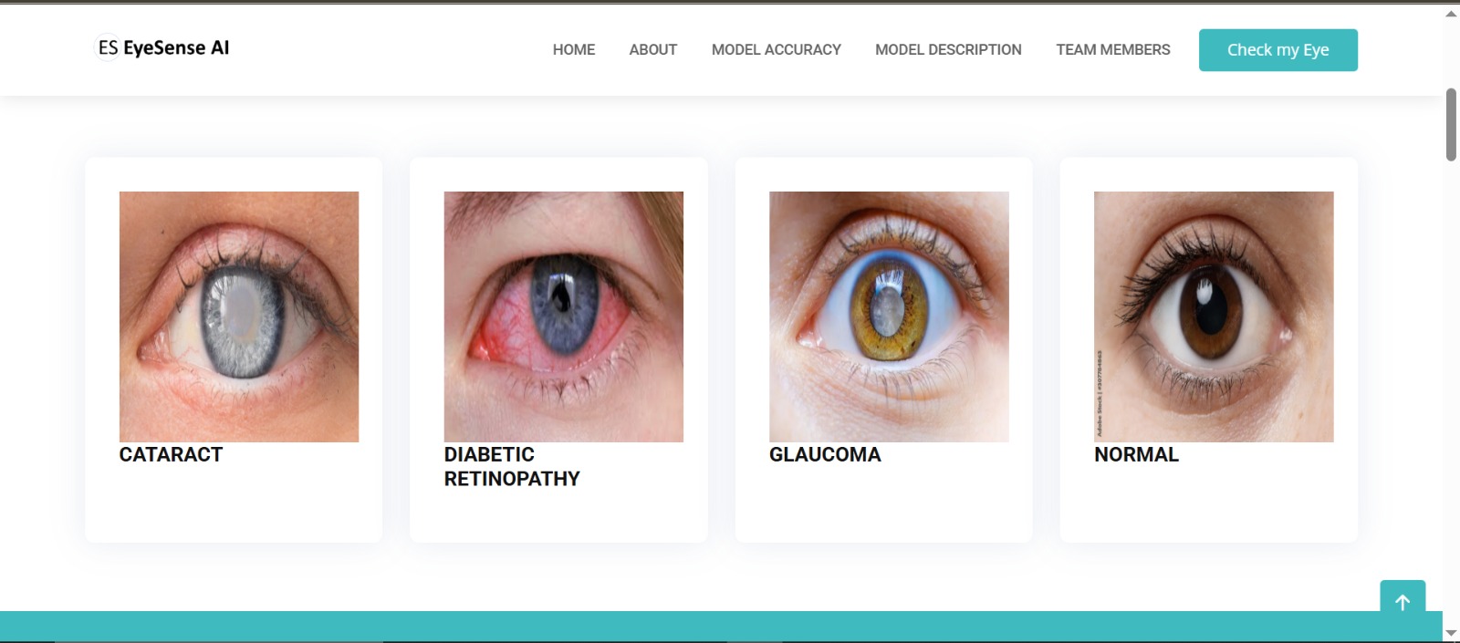 Eye Disease Detection